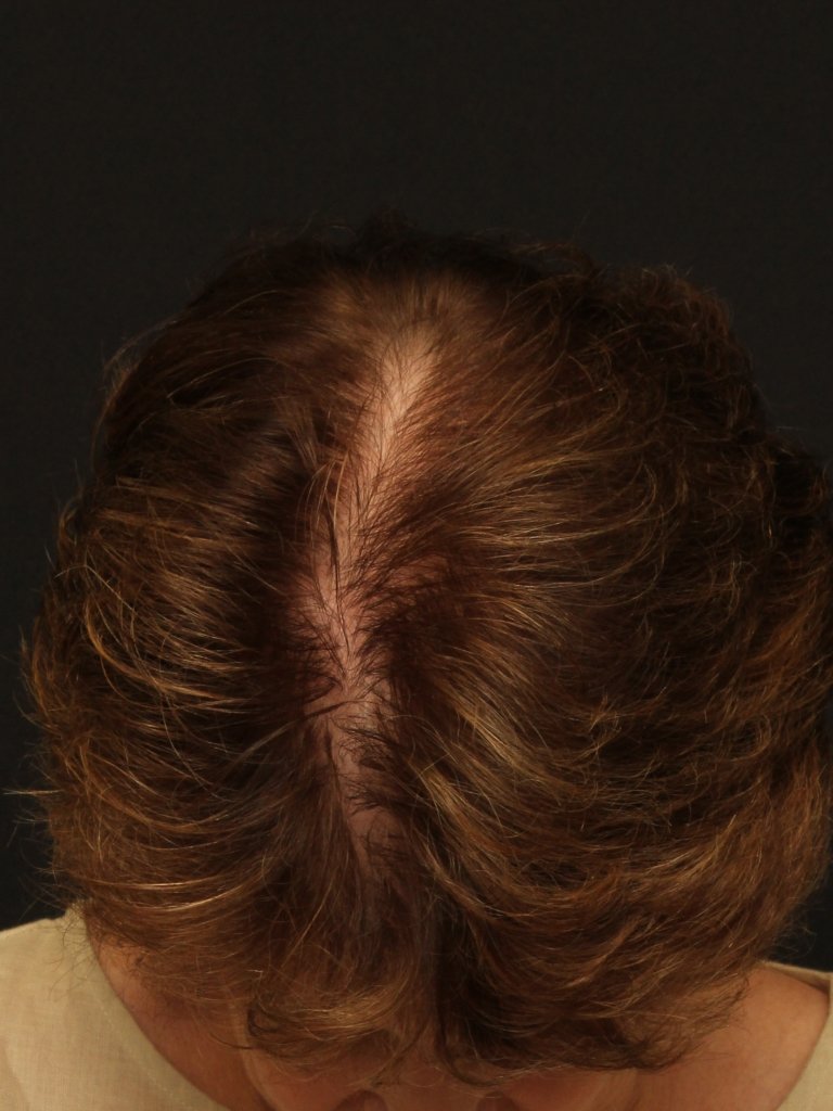 Female_After_1