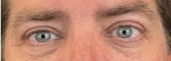 1_0002_ba-eye-03.webp copy
