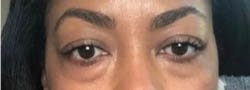 1_0005_ba-eye-05.webp