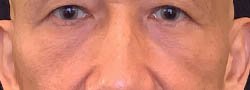 1_0016_unnamed-ba4.webp copy