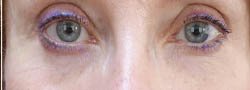 1_0018_unnamed-ba5.webp copy